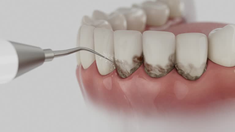 Trusted Wisdom Tooth Removal service in Citrus, CA - Dentist Open Now